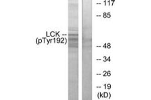 Western blot analysis of extracts from Jurkat cells, using Lck (Phospho-Tyr192) Antibody. (LCK 抗体  (pTyr192))