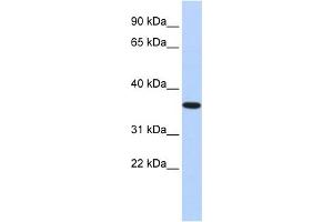 WB Suggested Anti-CPXCR1 Antibody Titration: 1 ug/ml Positive Control: Fetal Brain Lysate (CPXCR1 抗体  (Middle Region))