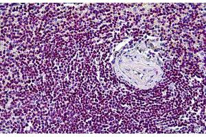 Human Spleen: Formalin-Fixed, Paraffin-Embedded (FFPE) (CDK6 抗体  (AA 3-100))