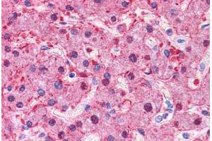 Human Liver: Formalin-Fixed, Paraffin-Embedded (FFPE) (Liver Arginase 抗体  (N-Term))