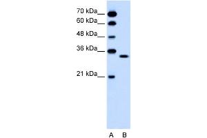 Western Blotting (WB) image for anti-Olfactory Receptor, Family 5, Subfamily T, Member 2 (OR5T2) (C-Term) antibody (ABIN2777026)