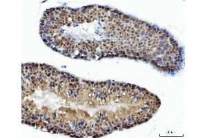 IHC analysis of ACLY using anti-ACLY antibody (ABIN4886416). (ACLY 抗体  (AA 1-180))