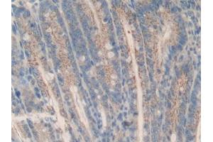 DAB staining on IHC-P; Samples: Mouse Intestine Tissue (MCL-1 抗体  (AA 2-307))