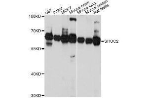 Western blot analysis of extracts of various cell lines, using SHOC2 Antibody. (SHoc2/Sur8 抗体  (AA 1-280))