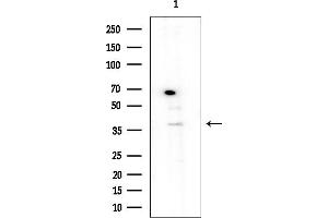 Western blot analysis of lysates from Rat brain, using SERPIN Antibody at 1/1000 dilution.