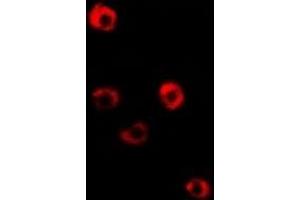 Immunofluorescent analysis of Tropomyosin 3 staining in Hela cells. (TPM3 抗体)