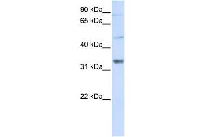 WB Suggested Anti-ZCCHC17 Antibody Titration:  0. (ZCCHC17 抗体  (Middle Region))