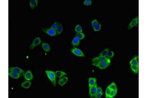 Immunofluorescent analysis of HepG2 cells using ABIN7159734 at dilution of 1:100 and Alexa Fluor 488-congugated AffiniPure Goat Anti-Rabbit IgG(H+L) (MTTP 抗体  (AA 19-151))