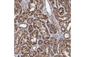 Immunohistochemical staining of human kidney with ACTR6 polyclonal antibody  shows strong cytoplasmic positivity in renal tubules.