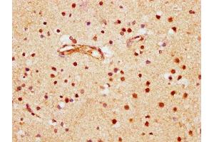 IHC image of ABIN7145804 diluted at 1:600 and staining in paraffin-embedded human brain tissue performed on a Leica BondTM system. (BRD1 抗体  (AA 756-879))