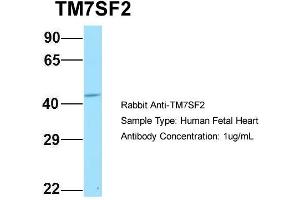 Host: Rabbit Target Name: TM7SF2 Sample Type: Human Fetal Heart Antibody Dilution: 1. (TM7SF2 抗体  (N-Term))