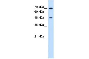 WB Suggested Anti-RAD23A Antibody Titration:  2. (RAD23A 抗体  (N-Term))