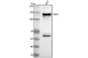 Western blot analysis of LRIG1 using anti-LRIG1 antibody (ABIN7602467).