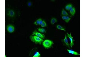 Immunofluorescent analysis of MCF-7 cells using ABIN7172949 at dilution of 1:100 and Alexa Fluor 488-congugated AffiniPure Goat Anti-Rabbit IgG(H+L) (TMCO5A 抗体  (AA 10-192))