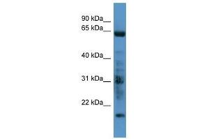 GRK7 antibody used at 0.