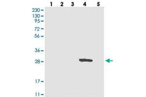 Western blot analysis of Lane 1: RT-4, Lane 2: U-251 MG, Lane 3: Human Plasma, Lane 4: Liver, Lane 5: Tonsil with DULLARD polyclonal antibody . (CTDNEP1A 抗体)