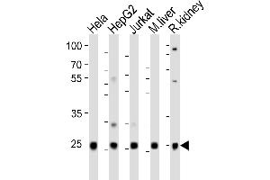 Western blot analysis of lysates from Hela, HepG2, Jurkat cell line, mouse liver, rat kidney tissue(from left to right), using UBB(Ubiquitin) Antibody (N-term) (ABIN6242685 and ABIN6577623). (Ubiquitin B 抗体  (N-Term))