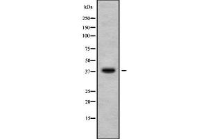 Western blot analysis of CA10 using HuvEc whole cell lysates (CA10 抗体  (C-Term))