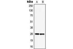 Western blot analysis of HOXB9 expression in MCF7 (A), HepG2 (B) whole cell lysates.