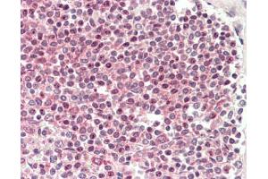 Immunohistochemistry (Paraffin-embedded Sections) (IHC (p)) image for anti-Protein Phosphatase 1, Catalytic Subunit, alpha Isoform (PPP1CA) (AA 280-330), (C-Term) antibody (ABIN2627089)
