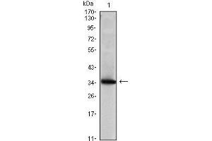 Western Blot showing SCGB2A2 antibody used against human SCGB2A2 (AA: 2-93) recombinant protein. (Mammaglobin A 抗体)