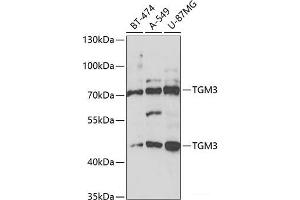 Western blot analysis of extracts of various cell lines using TGM3 Polyclonal Antibody at dilution of 1:1000. (TGM3 抗体)