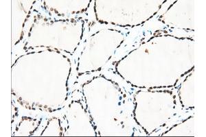 Immunohistochemical staining of paraffin-embedded Human lung tissue using anti-TACC3 mouse monoclonal antibody. (TACC3 抗体)