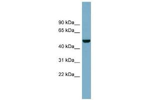 CSF1 antibody used at 1 ug/ml to detect target protein. (M-CSF/CSF1 抗体)