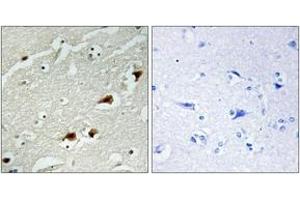 Immunohistochemistry (IHC) image for anti-Nuclear Factor-kB p65 (NFkBP65) (AA 496-545) antibody (ABIN2889033) (NF-kB p65 抗体  (AA 496-545))
