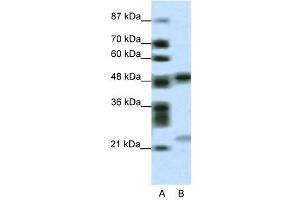 WB Suggested Anti-PHF11  Antibody Titration: 0. (PHF11 抗体  (Middle Region))
