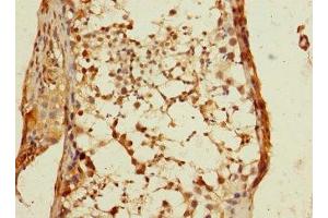 Immunohistochemistry of paraffin-embedded human testis tissue using ABIN7150696 at dilution of 1:100 (DSTYK 抗体  (AA 680-929))