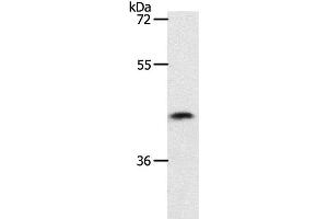 Western Blot analysis of 231 cell using PLAT Polyclonal Antibody at dilution of 1:450 (PLAT 抗体)