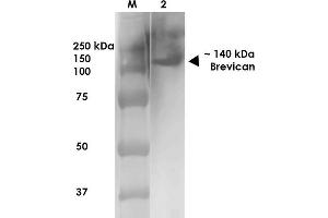 Western Blot analysis of Rat Brain Membrane showing detection of ~140 kDa Brevican protein using Mouse Anti-Brevican Monoclonal Antibody, Clone S294A-6 . (BCAN 抗体  (AA 219-655) (Biotin))