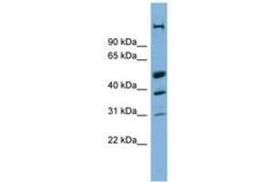 Image no. 1 for anti-CREB/ATF BZIP Transcription Factor (CREBZF) (AA 215-264) antibody (ABIN6742074) (CREBZF 抗体  (AA 215-264))
