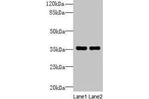 Western blot All lanes: NAIF1 antibody at 6 μg/mL Lane 1: Mouse brain tissue Lane 2: Mouse heart tissue Secondary Goat polyclonal to rabbit IgG at 1/10000 dilution Predicted band size: 36, 18 kDa Observed band size: 36 kDa (NAIF1 抗体  (AA 1-172))