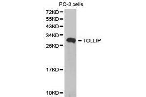 Western Blotting (WB) image for anti-Toll Interacting Protein (TOLLIP) antibody (ABIN1875154) (TOLLIP 抗体)