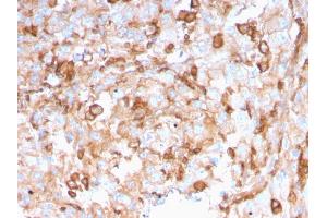 Formalin-fixed, paraffin-embedded human Kidney stained with PAI-RBP1 Mouse Monoclonal Antibody (SERBP1/3496). (SERBP1 抗体  (AA 3-139))