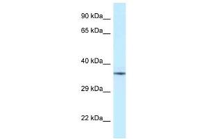 Western Blot showing NUDT6 antibody used at a concentration of 1 ug/ml against Fetal Brain Lysate (NUDT6 抗体  (Middle Region))