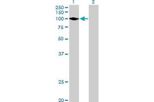 Western Blot analysis of HK2 expression in transfected 293T cell line by HK2 MaxPab polyclonal antibody. (Hexokinase 2 抗体  (AA 1-917))