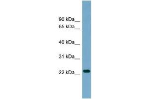 Human THP-1; WB Suggested Anti-ARL8B Antibody Titration: 0. (ARL8B 抗体  (Middle Region))