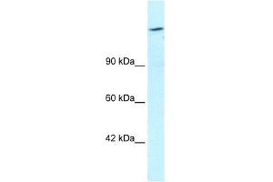 Human HepG2; WB Suggested Anti-ARID4A Antibody Titration: 1. (ARID4A 抗体  (C-Term))