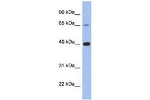 Image no. 1 for anti-Estrogen Receptor 1 (ESR1) (C-Term) antibody (ABIN6746024) (Estrogen Receptor alpha 抗体  (C-Term))