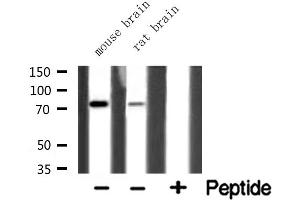 Western blot analysis of extracts of various tissue ,using HLX1 antibody. (HLX 抗体  (Internal Region))