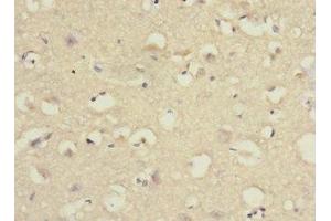 Immunohistochemistry of paraffin-embedded human brain tissue using ABIN7166554 at dilution of 1:100 (Protocadherin 1 抗体  (AA 515-715))