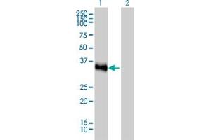 Western Blot analysis of CRX expression in transfected 293T cell line by CRX monoclonal antibody (M02), clone 4G11. (CRX 抗体  (AA 1-95))