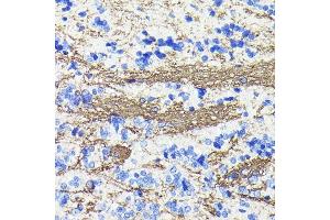 Immunohistochemistry of paraffin-embedded rat brain using CNPase Rabbit mAb (ABIN7265322) at dilution of 1:100 (40x lens). (Cnpase 抗体)