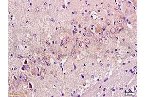 Formalin-fixed and paraffin embedded: rat brain tissue labeled with Anti-GAP-43 Polyclonal Antibody, Unconjugated (ABIN725555) at 1:300 followed by conjugation to the secondary antibody and DAB staining (GAP43 抗体  (AA 9-100))