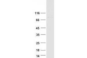 Western Blotting (WB) image for Zinc Finger Protein 567 (104092) protein (Myc-DYKDDDDK Tag) (ABIN2736070)