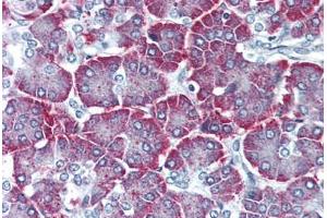 Pancreas, Human: Formalin-Fixed, Paraffin-Embedded (FFPE) (PTH2R 抗体  (N-Term))