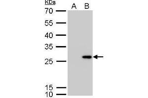 WB Image Calretinin antibody detects CALB2 protein by Western blot analysis. (Calretinin 抗体)